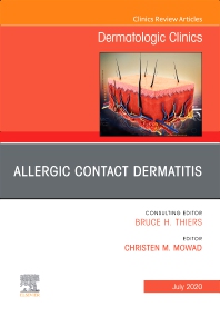 Allergic Contact Dermatitis Book