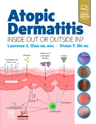 Atopic Dermatitis Book