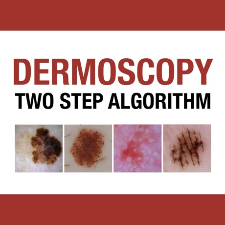 Dermoscopy App