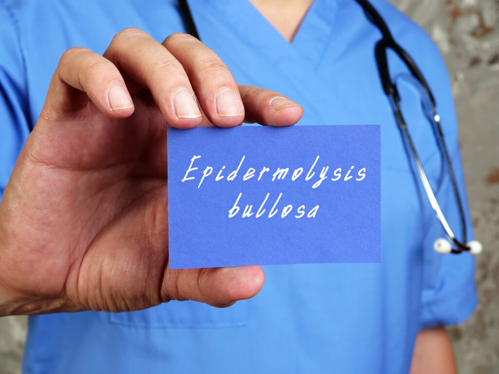 epidermolysis bullosa