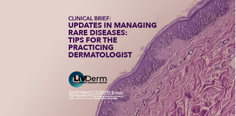 Updates in Managing Rare Diseases- Tips for the Practicing Dermatologist
