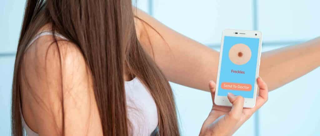 AI Dermatology Apps