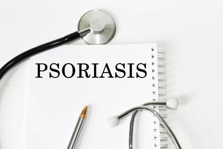 psoriasis