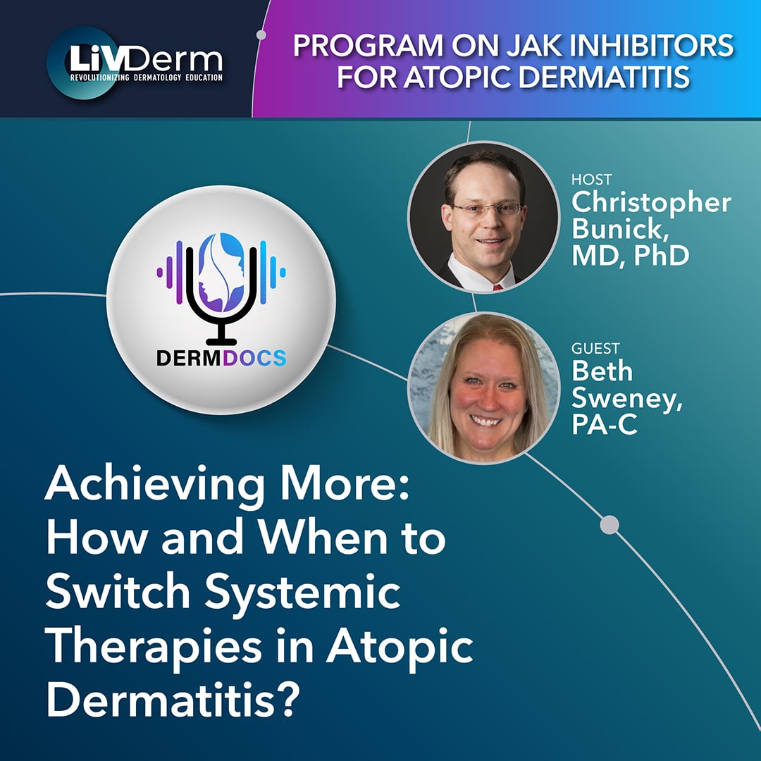 Achieving More How And When To Switch Systemic Therapies In Atopic