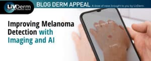 Melanoma Detection