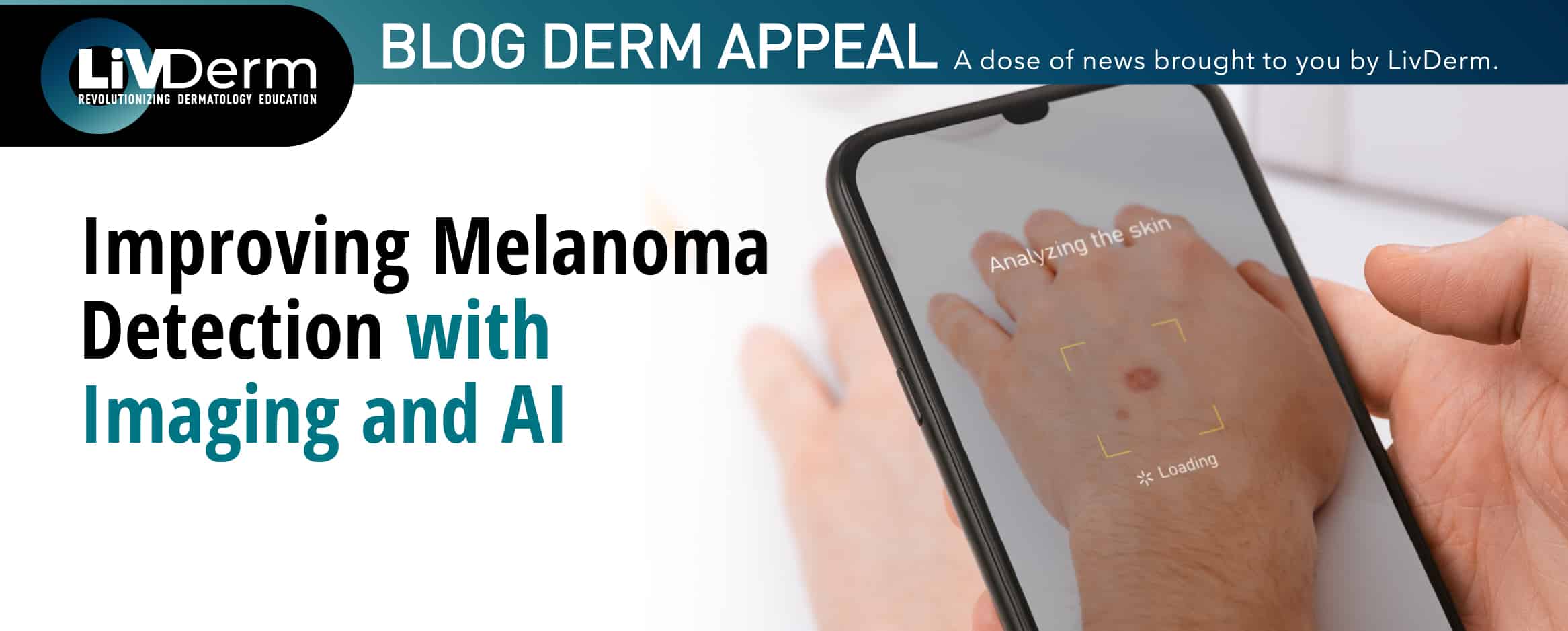 Melanoma Detection