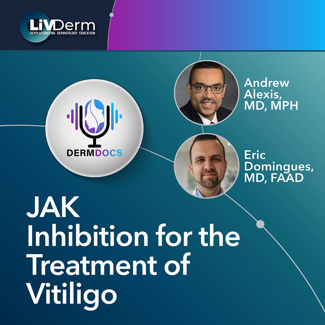 JAK Inhibition for the Treatment of Vitiligo