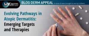 atopic dermatitis