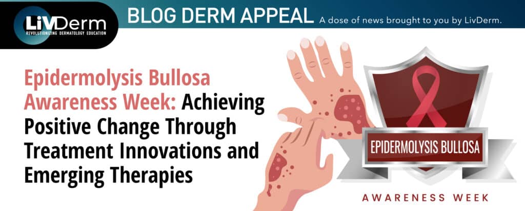 epidermolysis bullosa