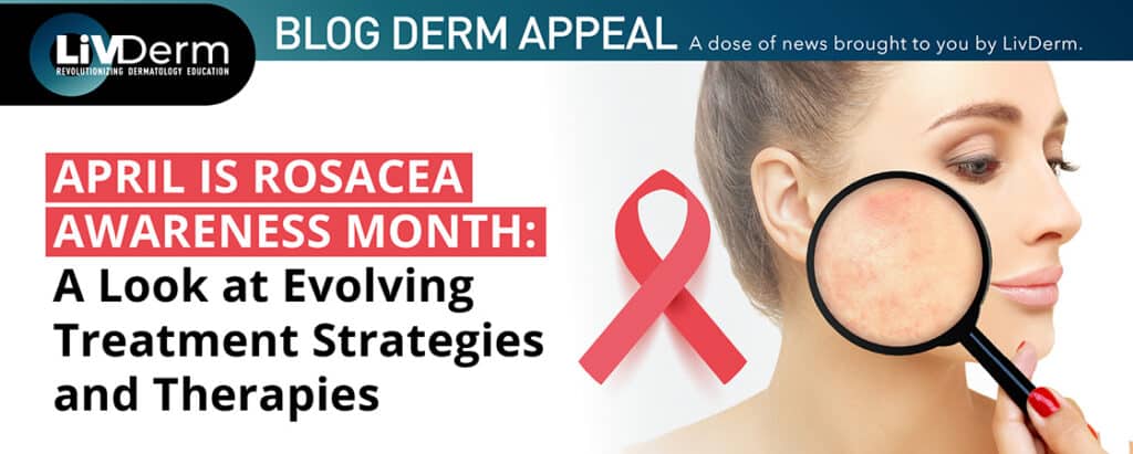 rosacea awareness