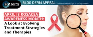 rosacea awareness