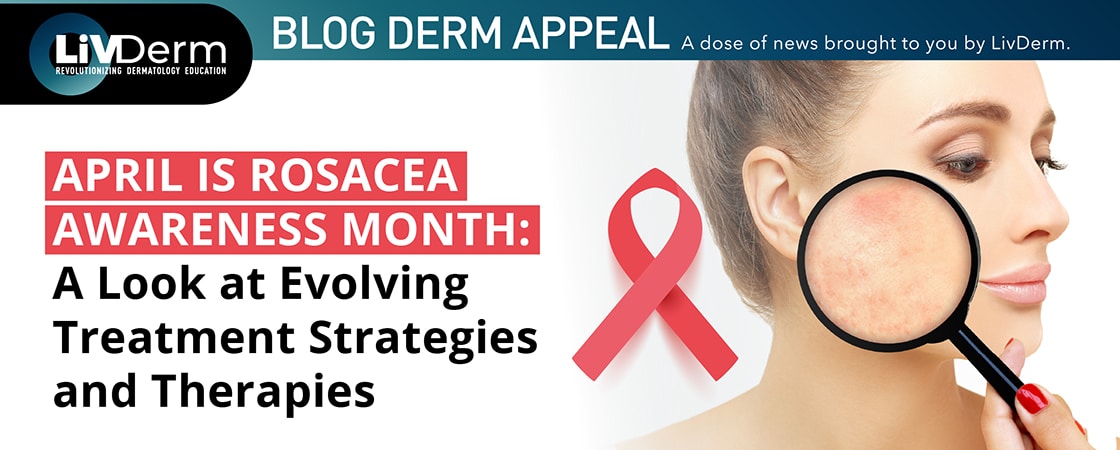 rosacea awareness