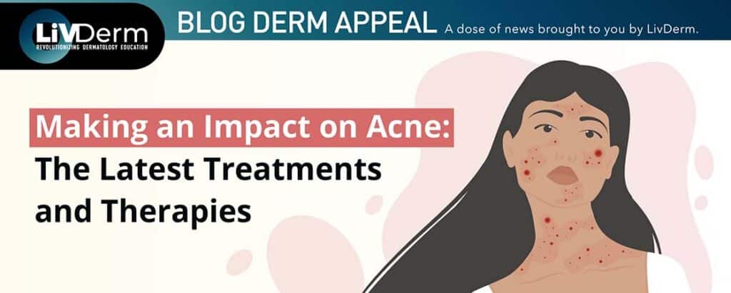 acne awareness