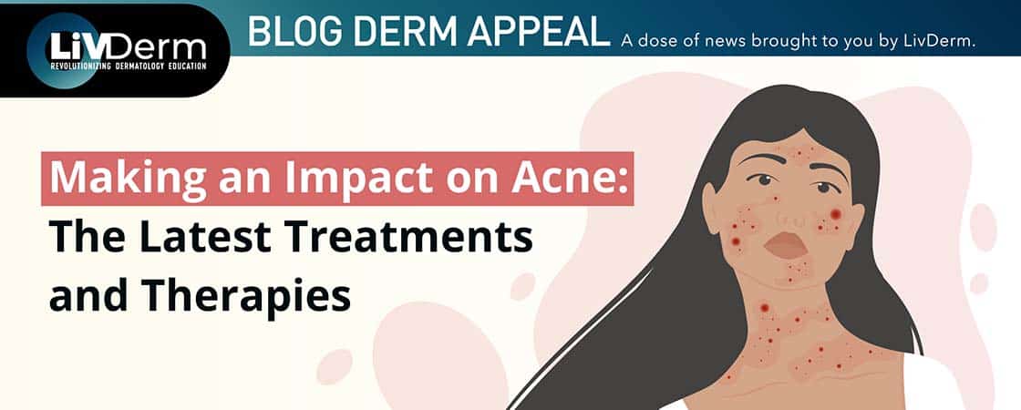 acne awareness