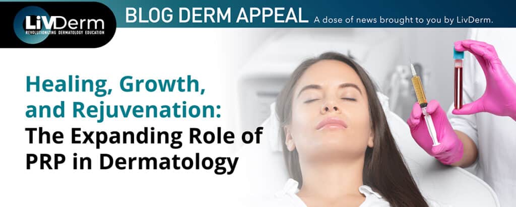 PRP in dermatology